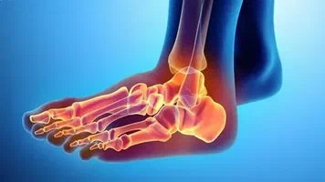 Achilles Tendinitis Treatment: Effective Ways to Relieve Pain and Recover Faster