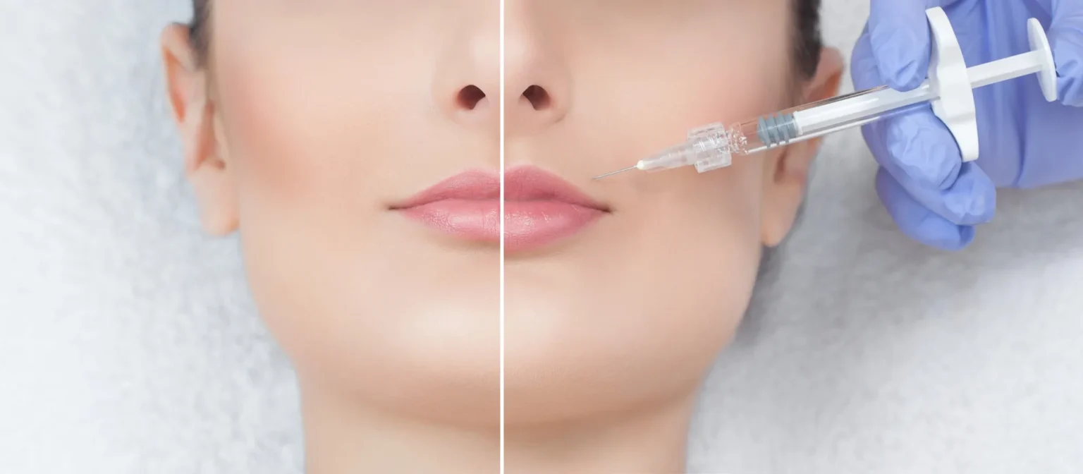 Botox or Fillers? A Simple Guide to Choosing the Right Injectable for Your Goals